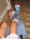 Der coole Gips an meinem hochgelegten Bein